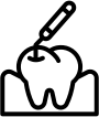 Lost Fillings - Emergency dentist Farnham